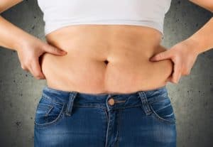 Common Cosmetic Procedures Needed After Weight Loss