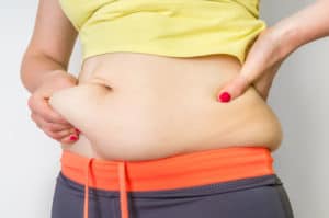 Tummy Tuck or Beltectomy