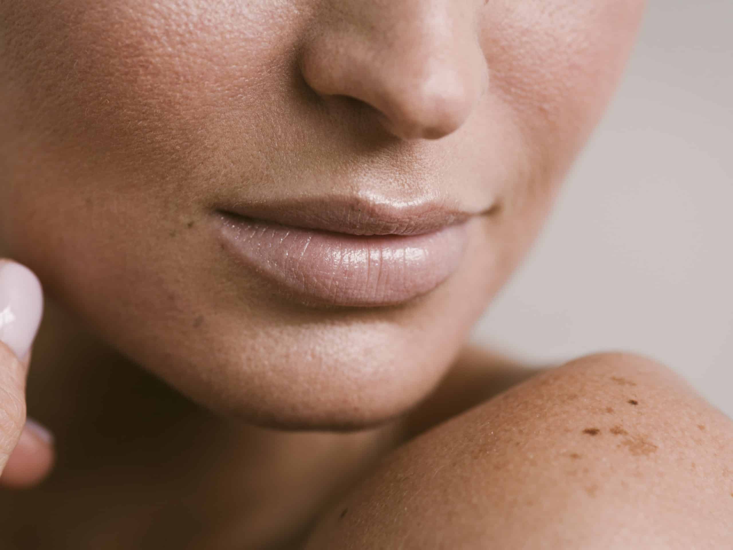 Julian Plastic Surgery - Skin Cancer Repair - melanoma