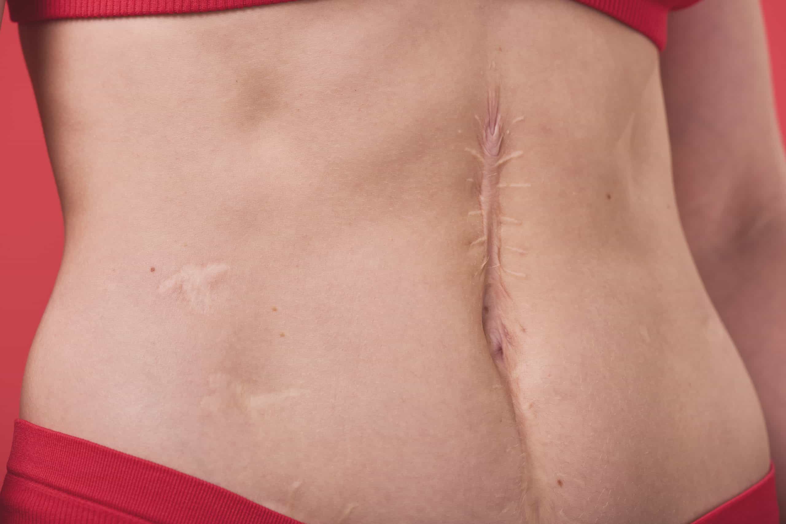 Julian Institute of Plastic surgery - reconstruction - scar revision header