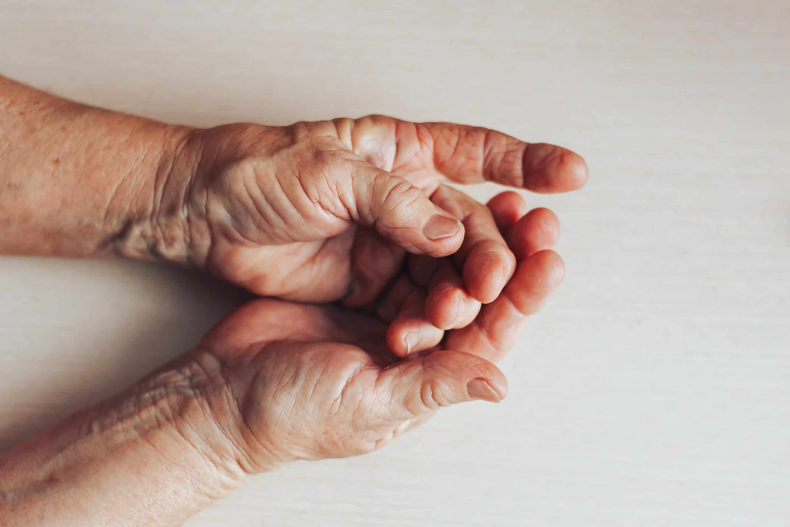 Julian Plastic Surgery - Hands and Arms - Trigger finger repair