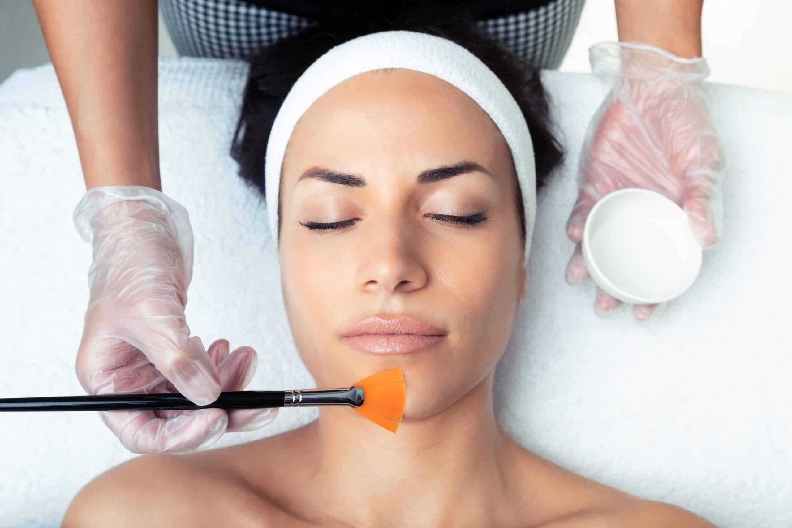 Julian Surgery - Procedures - Skin Care - chemical peels