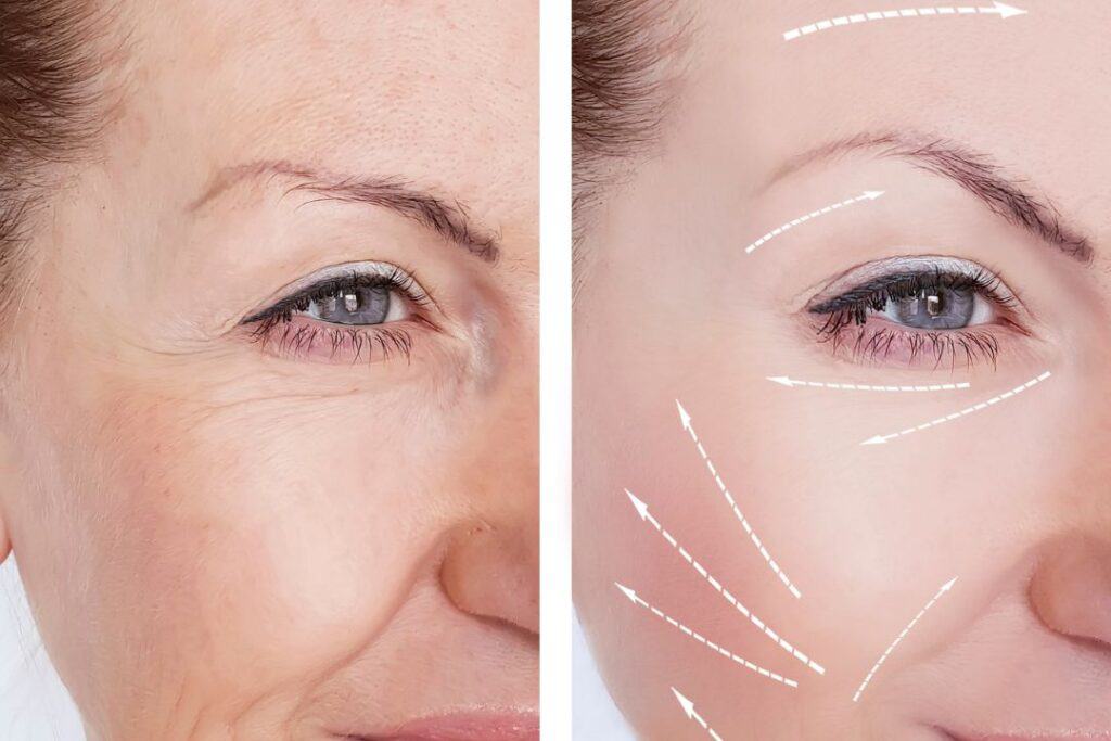 Plastic Surgery After 50: Common Procedures and What to Expect