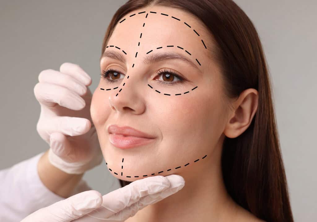 What Is the Undetectable Facelift?