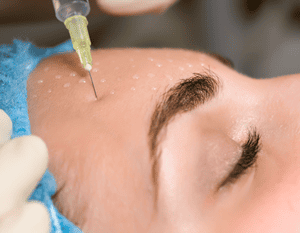 Botox Procedure by The Julian Institute of Plastic Surgery Botox and Filler